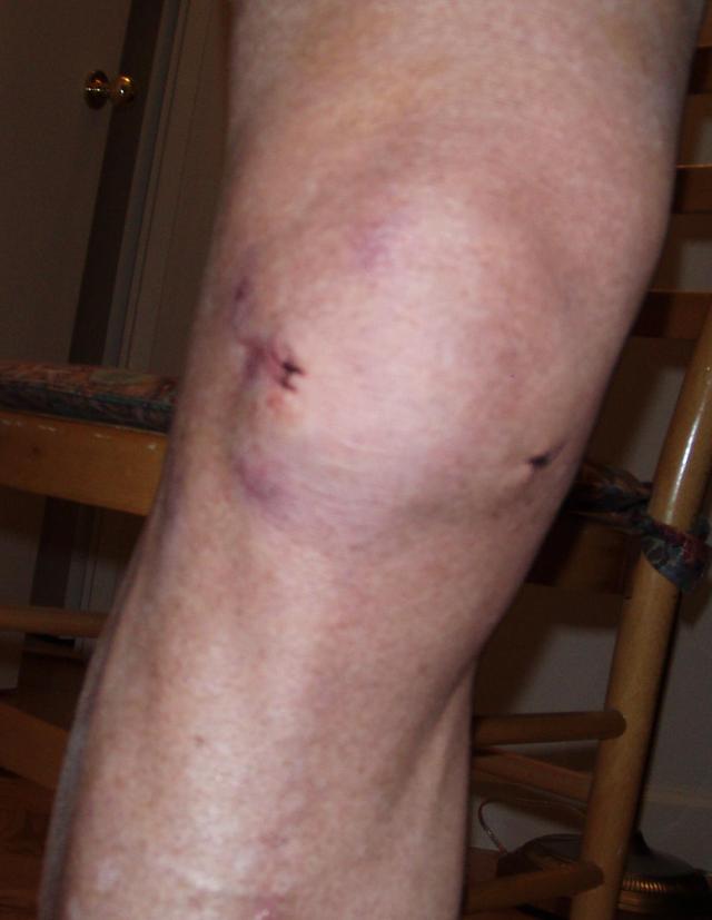 Arthroscopy_025_c