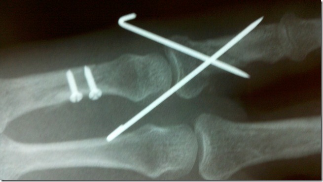 2011-02-16_11-50-04_711
