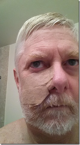 bandage at 48 hours